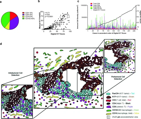 Lead figure from "Keratin 17 modulates the immune topography of pancreatic cancer" (Journal of Translational Medicine, 2024)