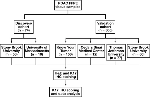 Lead figure from "Keratin 17 is a prognostic and predictive biomarker in pancreatic ductal adenocarcinoma" (American Journal of Clinical Pathology, 2024)