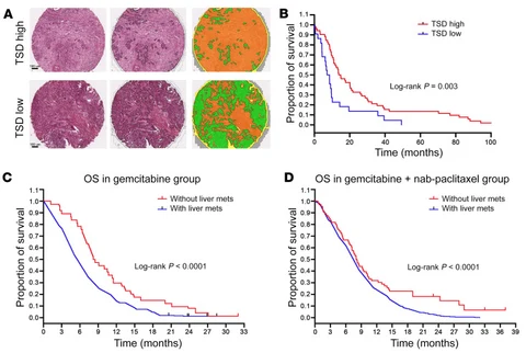 Lead figure from "Pancreatic ductal adenocarcinoma progression is restrained by stromal matrix" (Journal of Clinical Investigation, 2020)